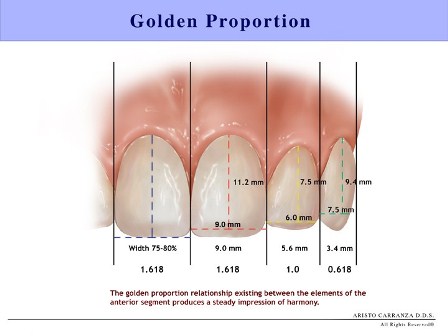 Smile design tooth proportiions